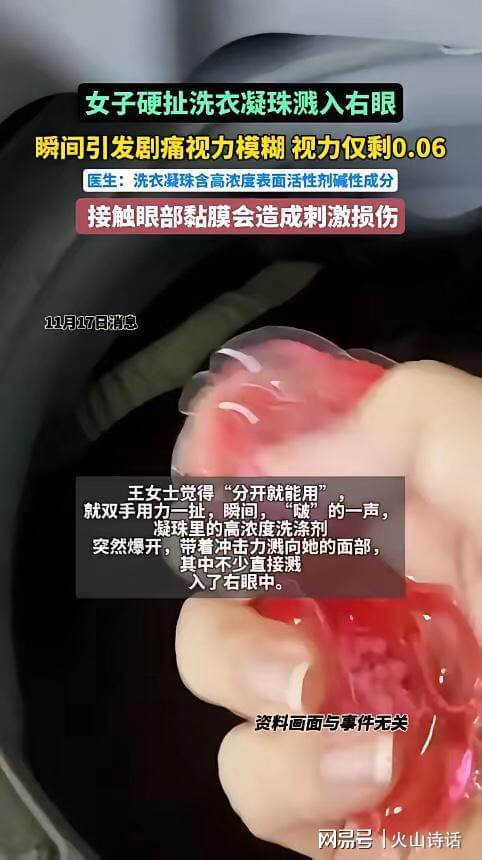 杭州一女子撕扯凝珠发生意外致眼睛失明AG真人娱乐恐怖！洗衣引发“爆炸”(图2)